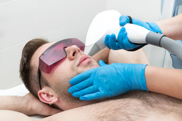 Man,On,The,Procedure,Of,Laser,Hair,Removal,In,The